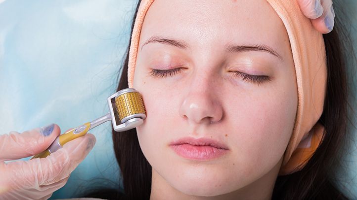 How Often Should You Microneedle Your Face