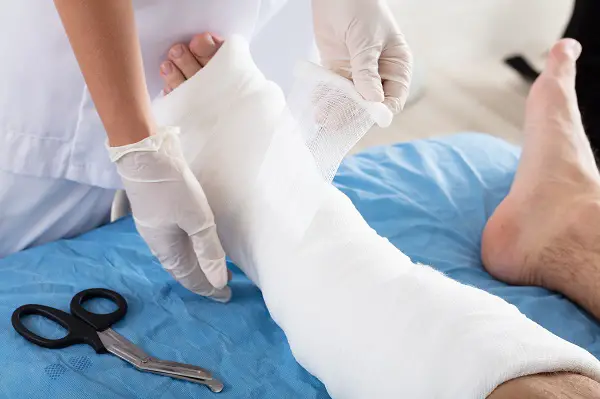 Can You Remove a Plaster Cast at Home