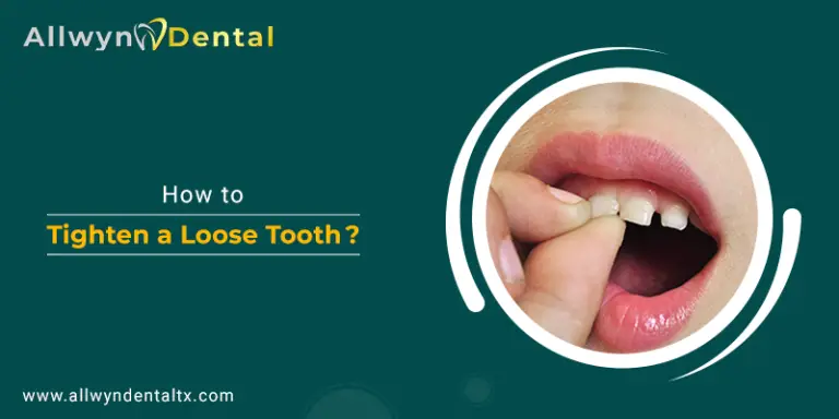 How Do You Tighten A Loose Tooth Fast?